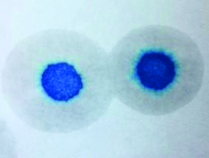 Methylene Blue Test